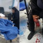 Extorsionador pierde dedos y parte del brazo al explotarle artefacto en Guayaquil; Policía lo captura en hospital